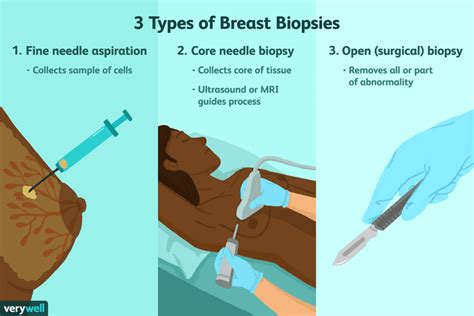 breast biopsy inconclusive